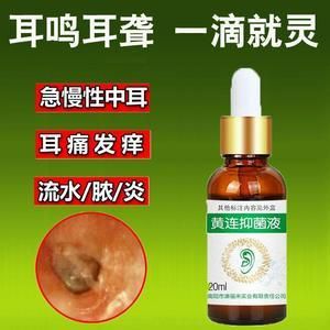 耳朵有稀耳屎用什么药（耳朵有稀耳屎用什么药效果好）-图3