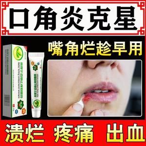 嘴皮伤了用什么药（嘴皮有伤口用什么药）-图3