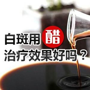 关于白癜风醋可以吃吗的信息-图1