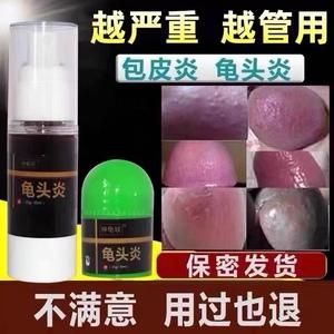 龟头痒可以用什么药（龟 头上炎症用什么药好）-图2