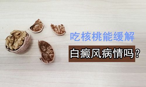 吃核桃治白癜风（吃核桃能治白头发吗）-图1