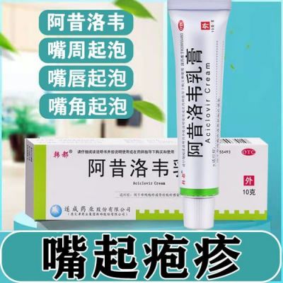 上火嘴角起泡用什么药（上火嘴角起泡用什么药膏好得快）-图3