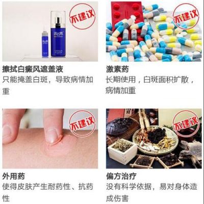 白癜风不可以吃的药物的简单介绍-图2