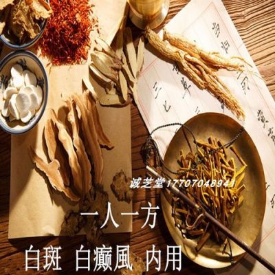 白癜风吃中药能有帮助吗（白点癫风吃中药调理能治好吗）-图1