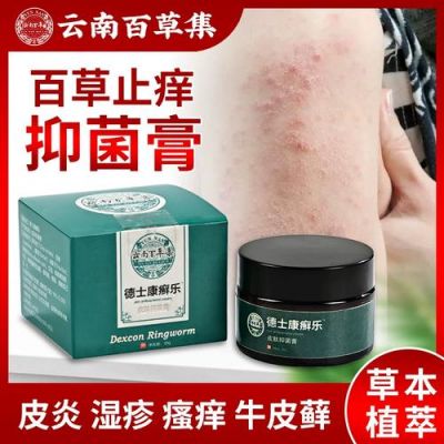 腿上皮肤痒用什么药（腿上瘙痒用什么药）-图2