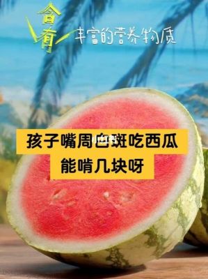 关于白癜风能大量吃西瓜吗的信息-图2