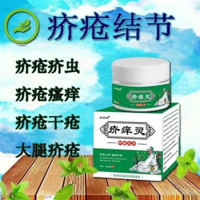 除虱子用什么药（除虱子用什么药膏最好）-图3