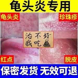 鬼头溃疡用什么药（龟 头上有溃疡怎么治疗最好）-图3