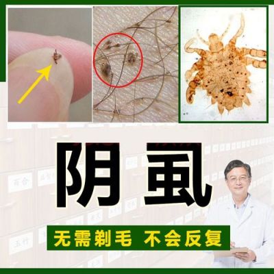 虱子咬的涂什么药（虱子咬要涂什么药好得快）-图3