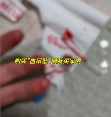 自残疤痕用什么药（自残疤痕去除）-图2