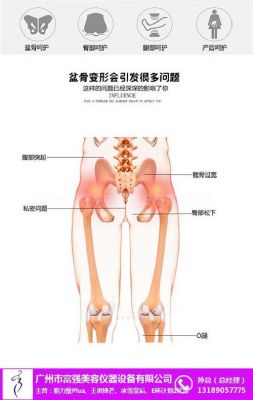 胯骨闪了用什么药（胯骨闪了怎么能好）-图3