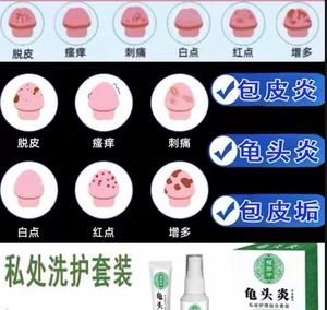 阴茎白色污垢用什么药的简单介绍-图2