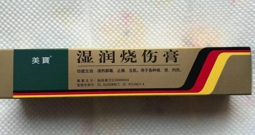 治烫伤用什么药（治烧烫伤什么药最好）-图3