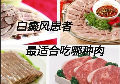 白癜风可以吃啥肉类的简单介绍-图2