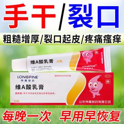 治裂手的药叫什么药（治裂手的药叫什么药膏）-图2