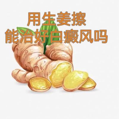 白癜风患者可以吃姜么的简单介绍