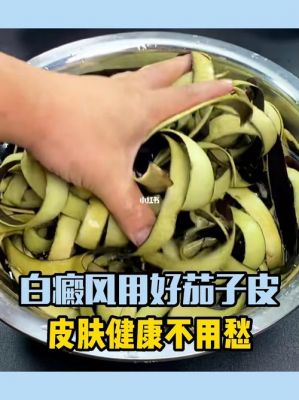 白癜风吃茄子行吗（白斑可以吃茄子吗）-图2