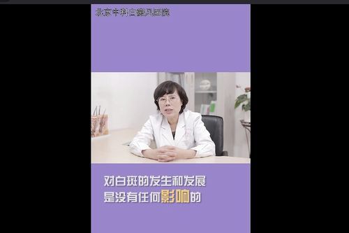 白癜风病人吃巧克力可以吗（白斑可以吃巧克力吗）