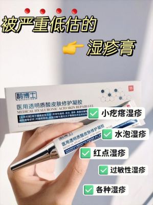 水泡型湿疹用什么药（水泡型湿疹用什么药好）-图3