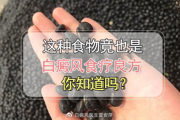 白癜风可以吃蛋类的简单介绍-图2