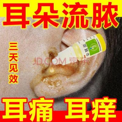 耳背裂开用什么药（耳背出现裂痕）-图1