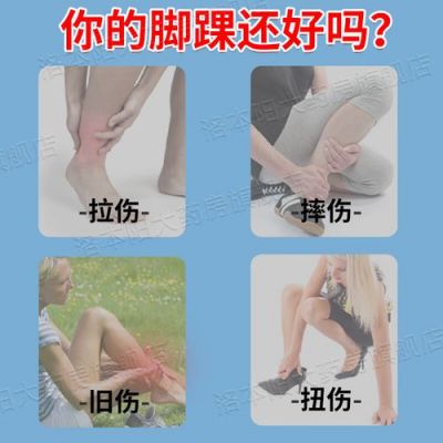 脚崴了该用什么药（脚崴了用什么药能快速好消肿止痛）-图3