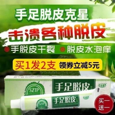 手夏天脱皮用什么药（夏天手上脱皮吃什么药）-图2