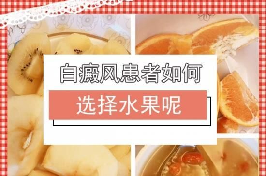 关于白癜风可以吃橘子和柿子吗的信息-图1