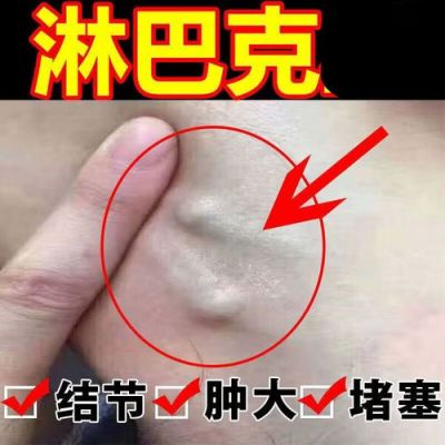 腋下淋巴结肿大吃什么药（腋下淋巴结肿大吃什么药效果好）-图2