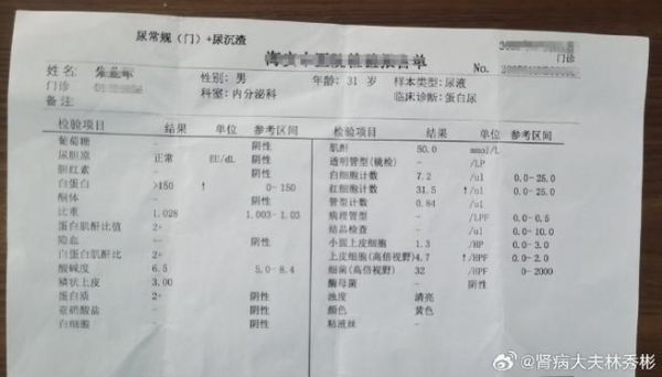 尿检红细胞高吃什么药（尿检红细胞偏高吃什么药）-图3