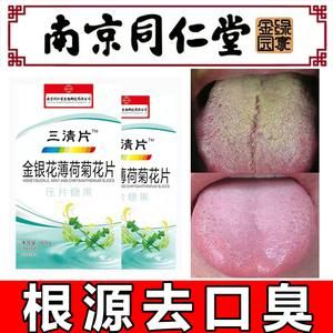 舌苔很厚发黄吃什么药（舌苔厚发黄吃什么药好）-图3