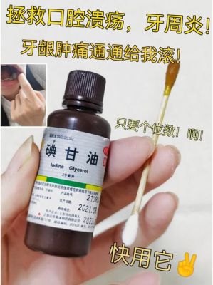 牙周炎什么药最见效（牙周炎什么药最见效最快）-图1