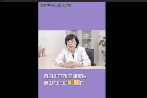 白癜风病可以吃巧克力吗（白斑病能吃巧克力吗）