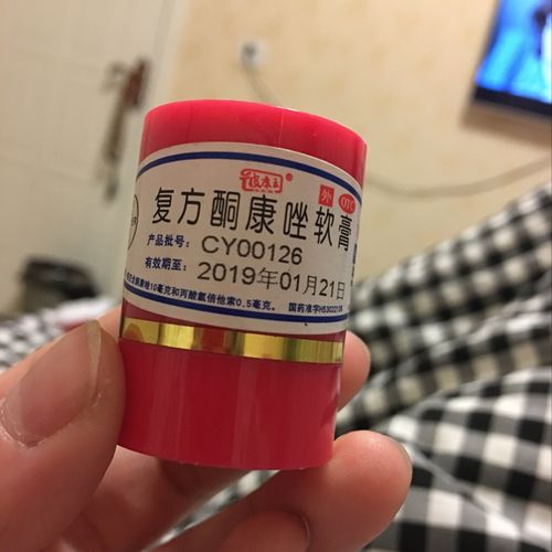 腋窝痒搽什么药（腋窝痒涂什么药膏）-图1