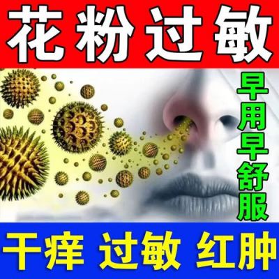 花粉过敏开什么药（花粉过敏开什么药吃）-图1