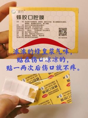 嘴巴烫伤起泡用什么药（嘴巴烫伤起泡用什么药膏）-图3