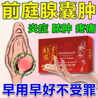 妇科囊肿用什么药（妇科囊肿用什么药膏）-图2