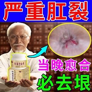 肛门附近裂口用什么药（肛门边裂口用什么药）-图2