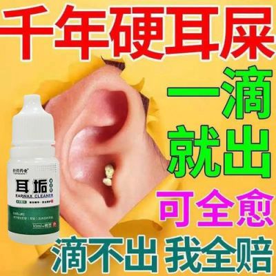 油耳屎用什么药（油耳屎用什么工具）-图3