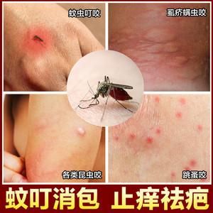 虫子叮咬后用什么药（虫子叮咬涂什么药）-图2