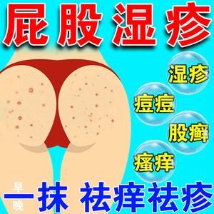 肛门泡疹用什么药（肛门疱疹用什么药最好的方法）