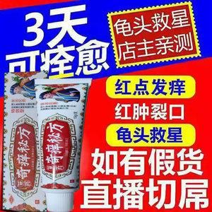 包含阴茎下面痒吃什么药的词条-图2