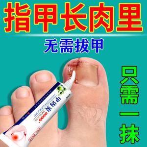 脚趾受伤用什么药（脚趾受伤吃什么恢复快）-图2