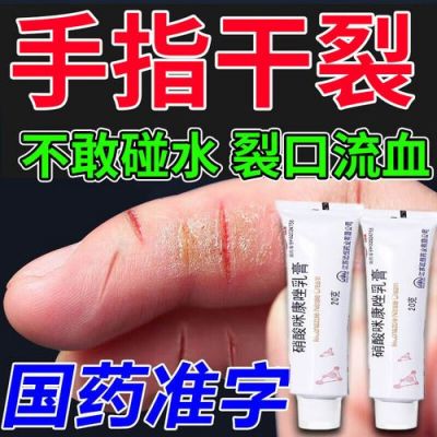 手掉皮用什么药（手掉皮用什么药膏最有效果）