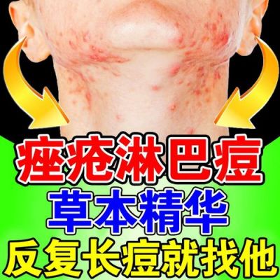 腮帮磨破吃什么药（腮帮子里边破了吃啥药能好得快）-图3