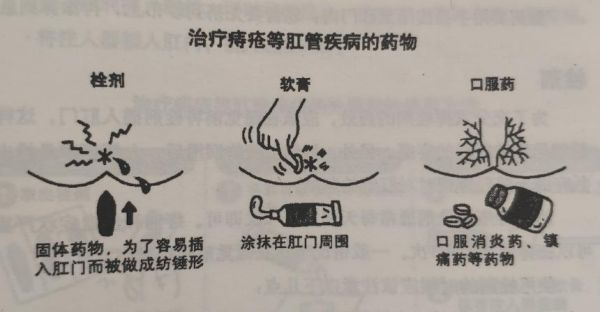 痔疮起泡上什么药（痔疮长泡怎么治疗）-图2