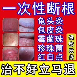 睾丸的皮痒要用什么药（睾丸皮痒用什么药膏 治疗）-图2