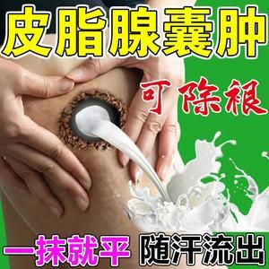 巴氏腺囊用什么药（巴氏腺囊有什么危害）-图1