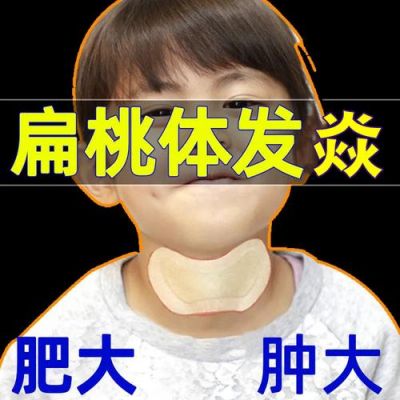 腭扁桃体肿大吃什么药（腭扁桃体肿大需要做手术吗）-图3