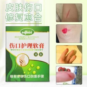 小孩摔伤后用什么药（小孩摔伤了用什么药）-图3